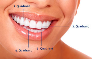 Die vier Quadranten im FDI-Zahnschema
