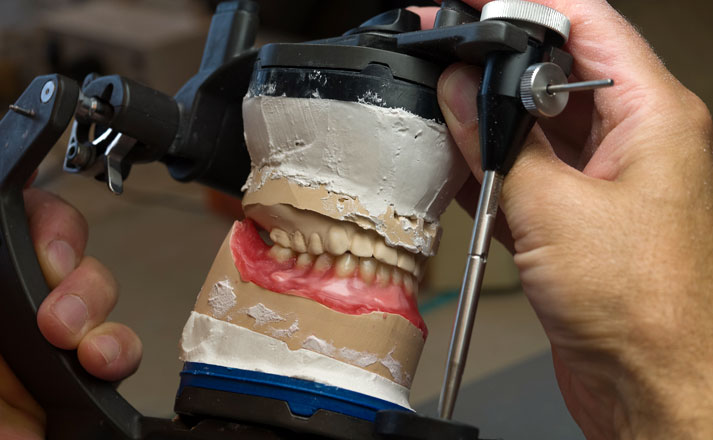 Anfertigung einer hochwertigen Zahnprothese im Dentallabor