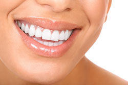 eine professionelle Zahnreinigung ergänzt die Mundhygiene